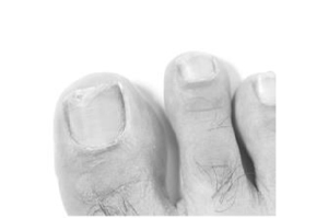 TERBINAFIN-1A Pharma Nagell.g.Nagelpilz 78,22 mg/ml, 6,6 ml