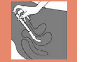 CLOTRIMAZOL AL 2% vaginalkräm, 20 g