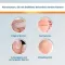 EndWarts® CLASSIC -lösning, 3 ml